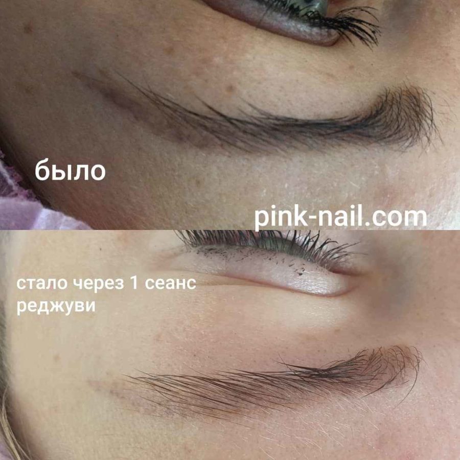 Удаление перманентного макияжа Минск Розовая пантера